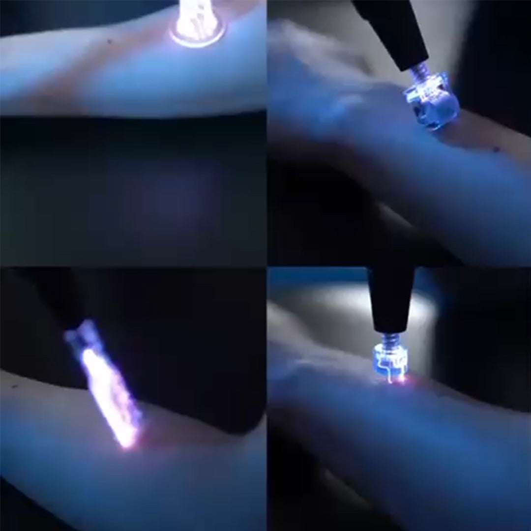 PlasmaFuse Neo: Advanced Dual-Plasma System for Total Skin Renewal