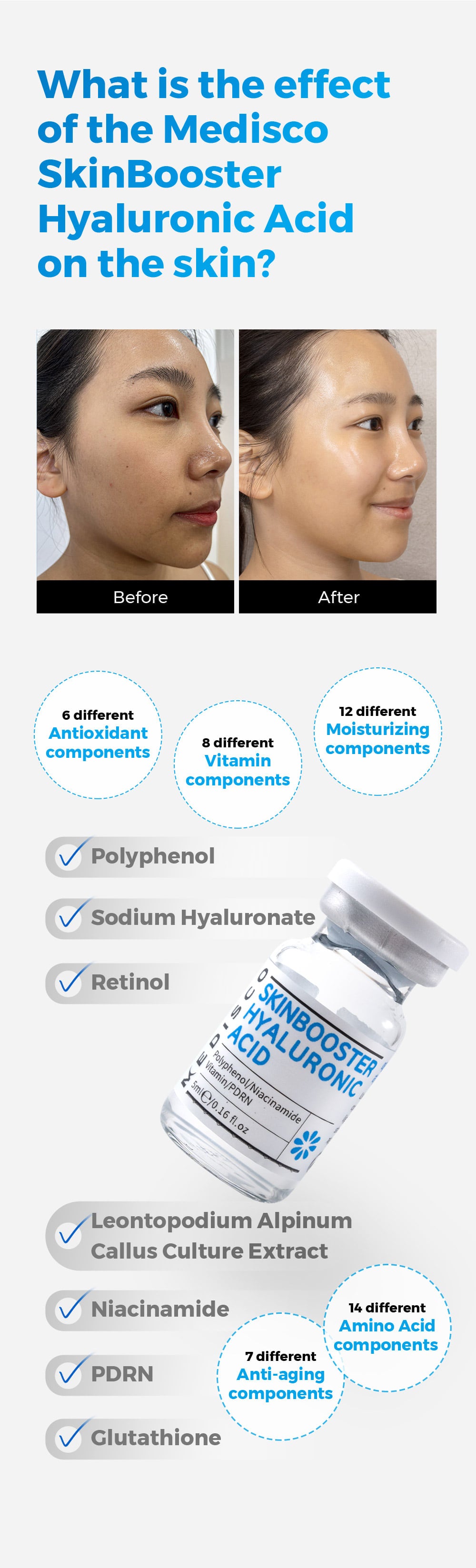 Refuerzo de la piel de Medisco