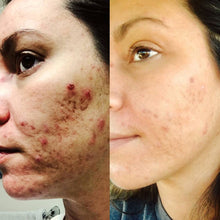 Cargar imagen en el visor de la galería, Peeling Jessner modificado Dermodality 1oz
